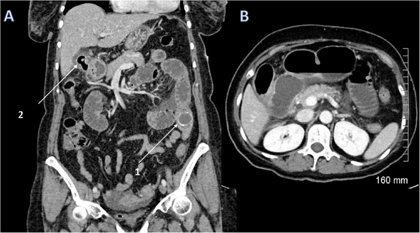 Fig. 21