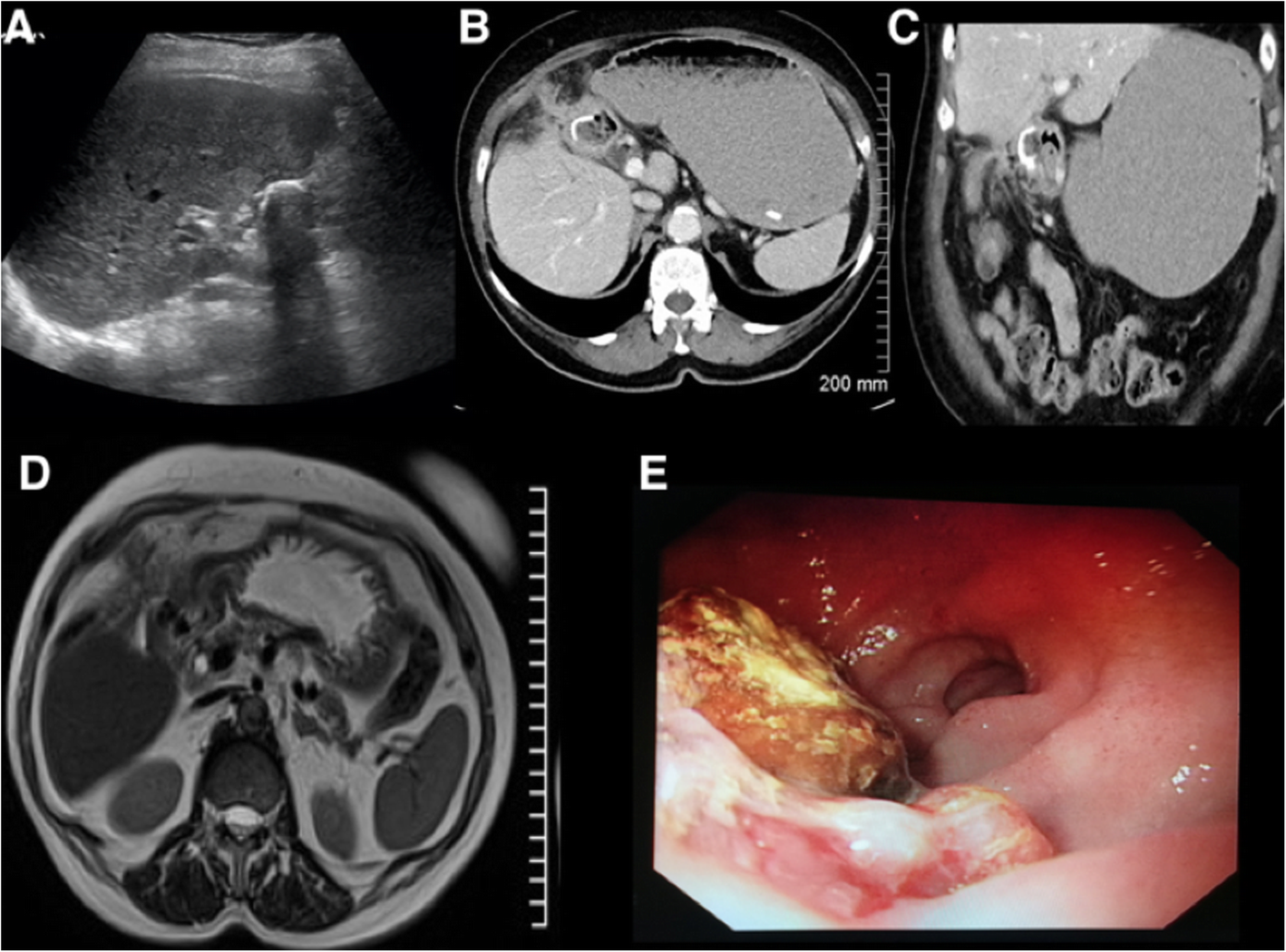 Fig. 22