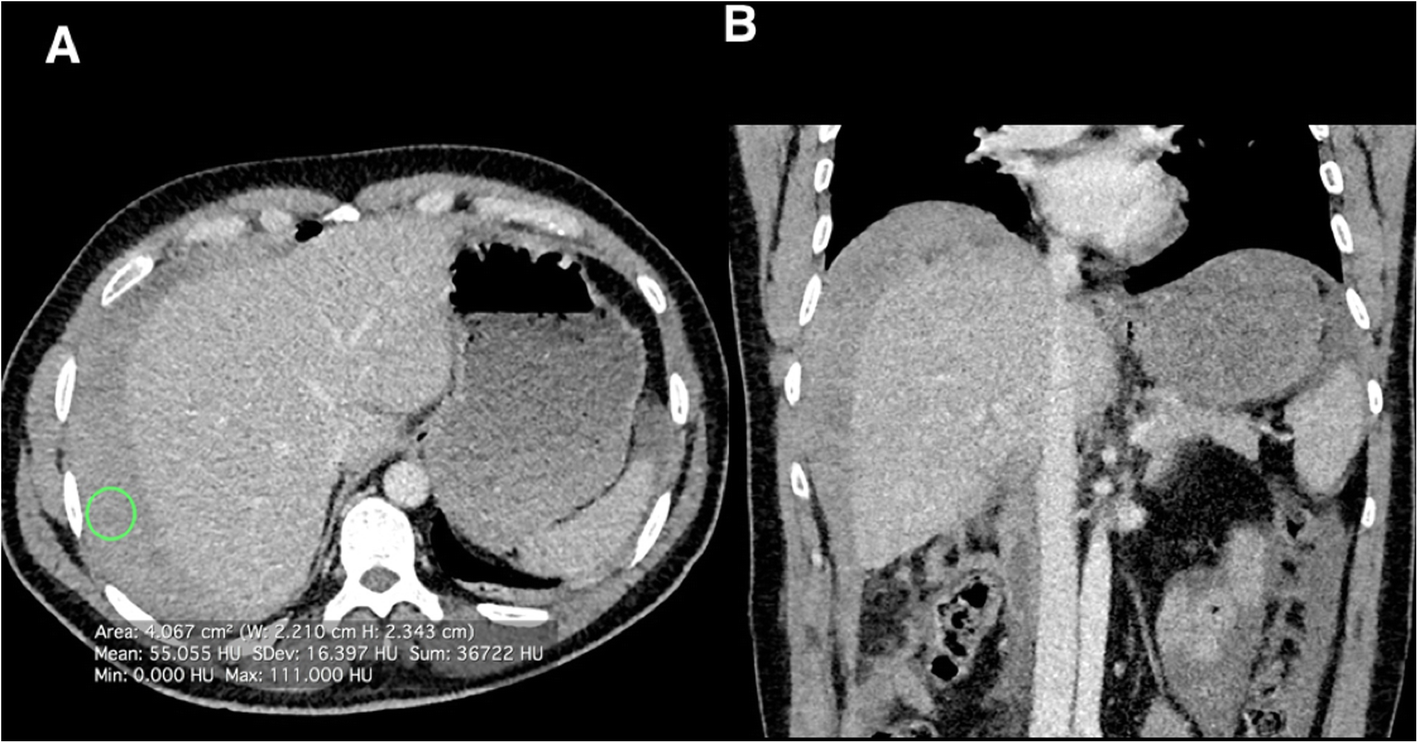 Fig. 23