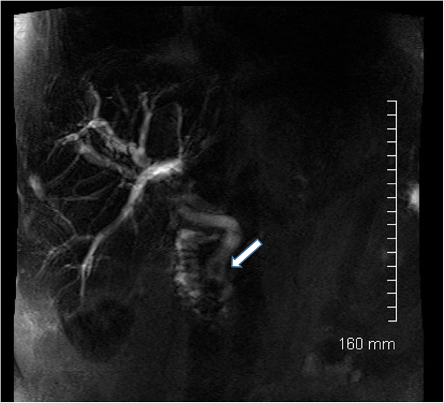 Fig. 25