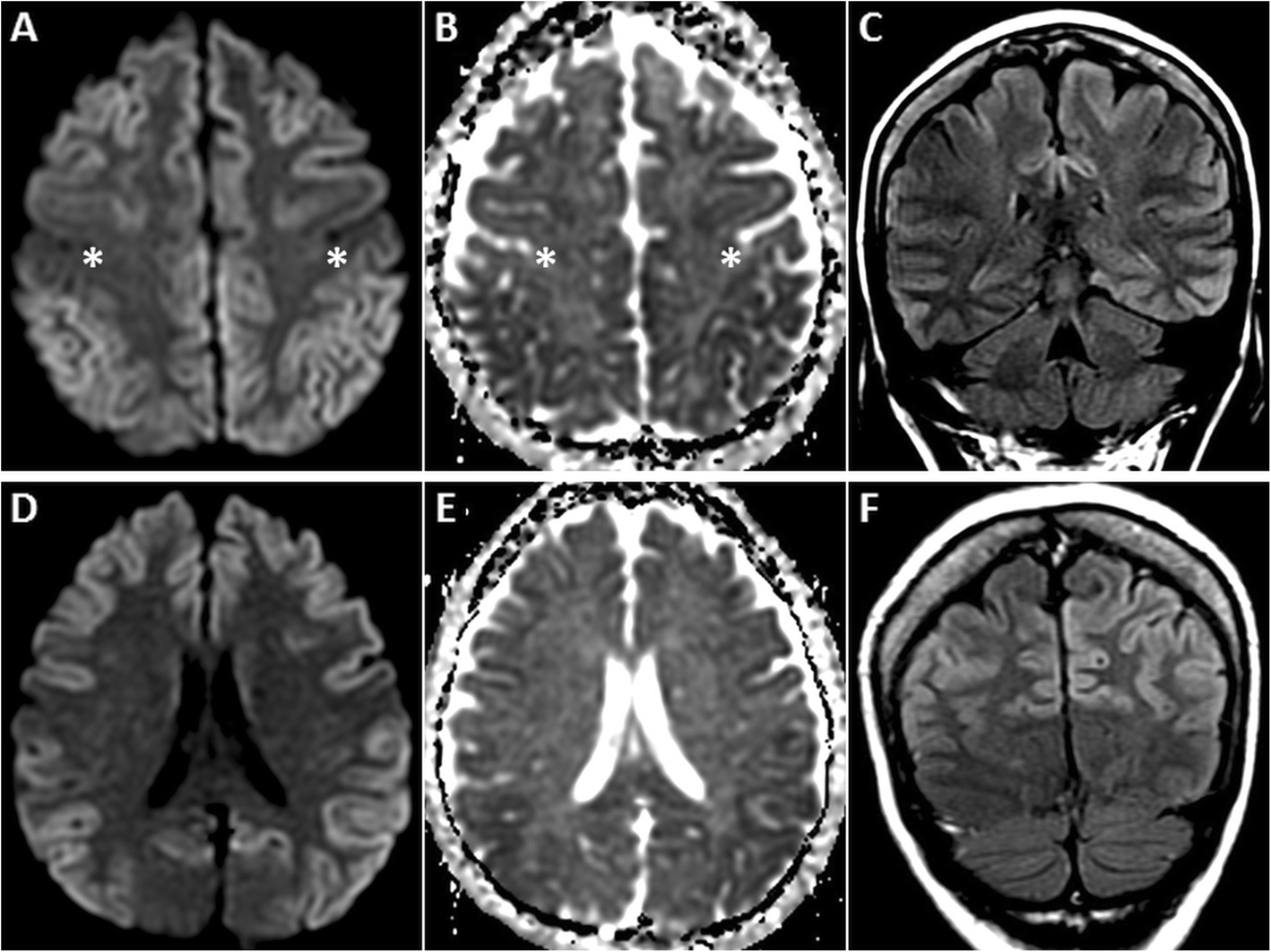 Fig. 9