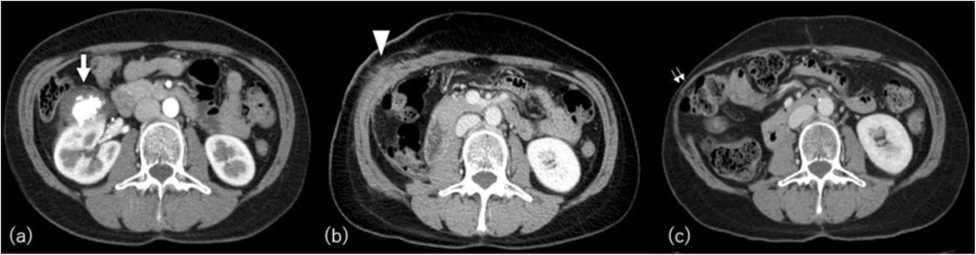 Fig. 13