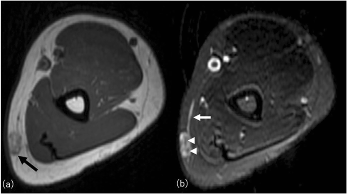 Fig. 17