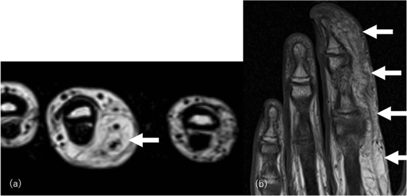 Fig. 19