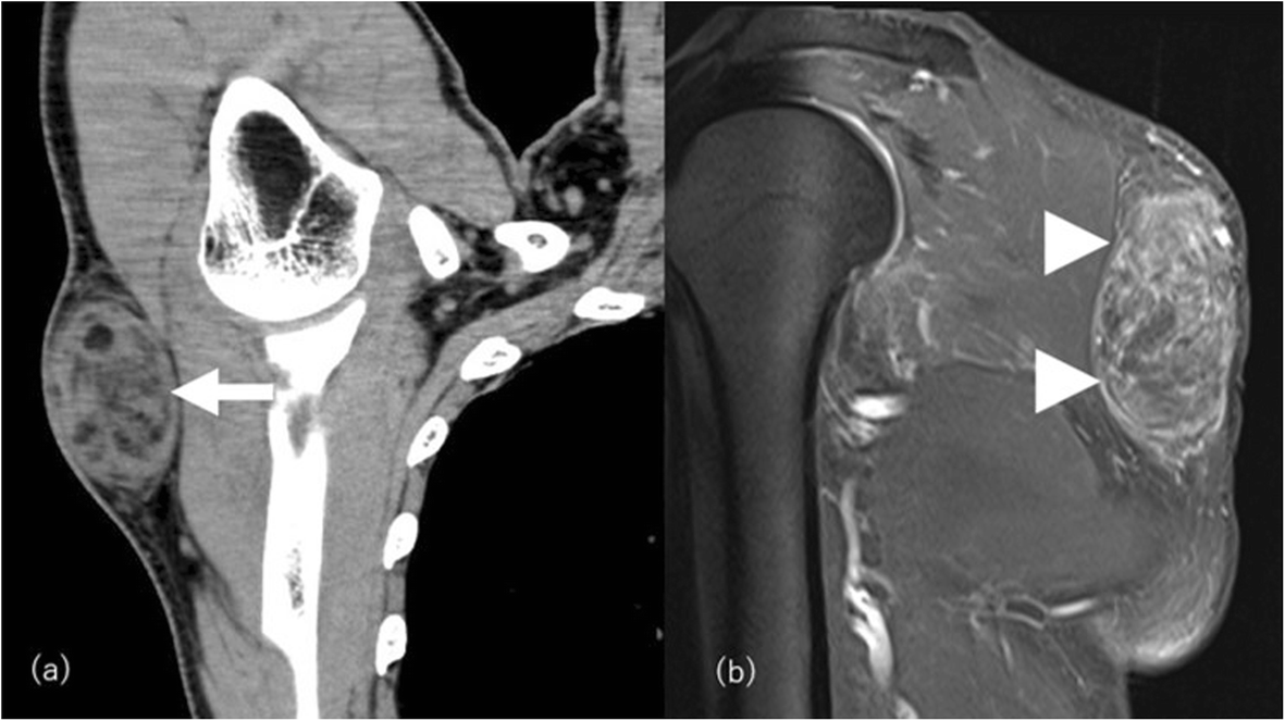 Fig. 20