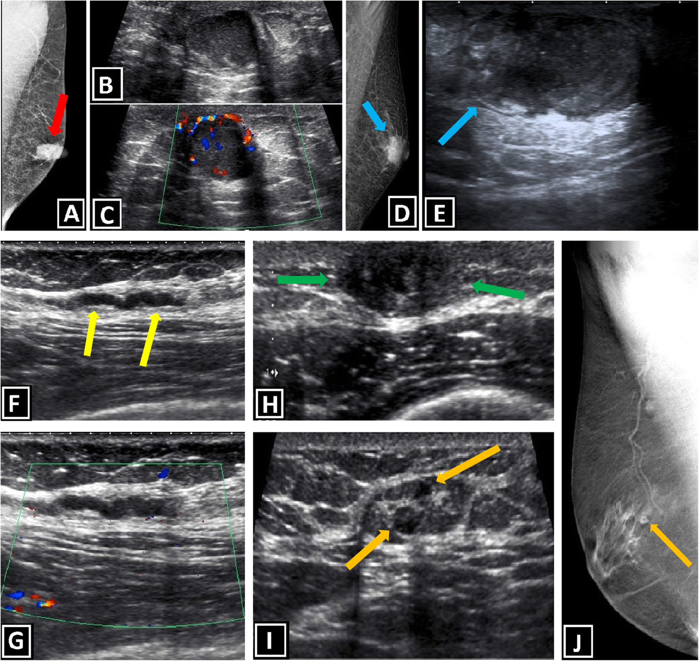 Fig. 10