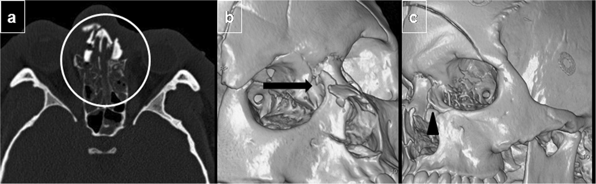 Fig. 10