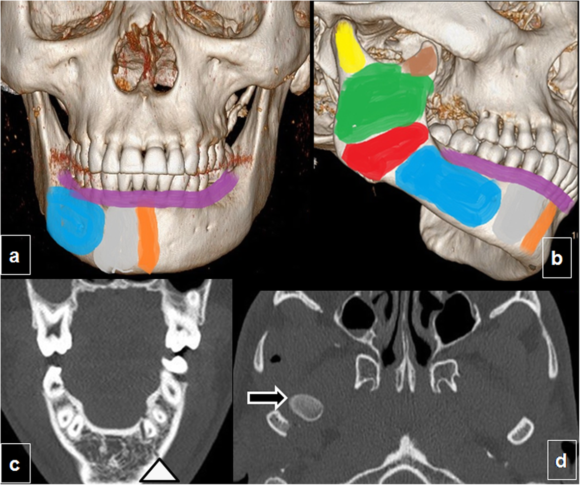 Fig. 12