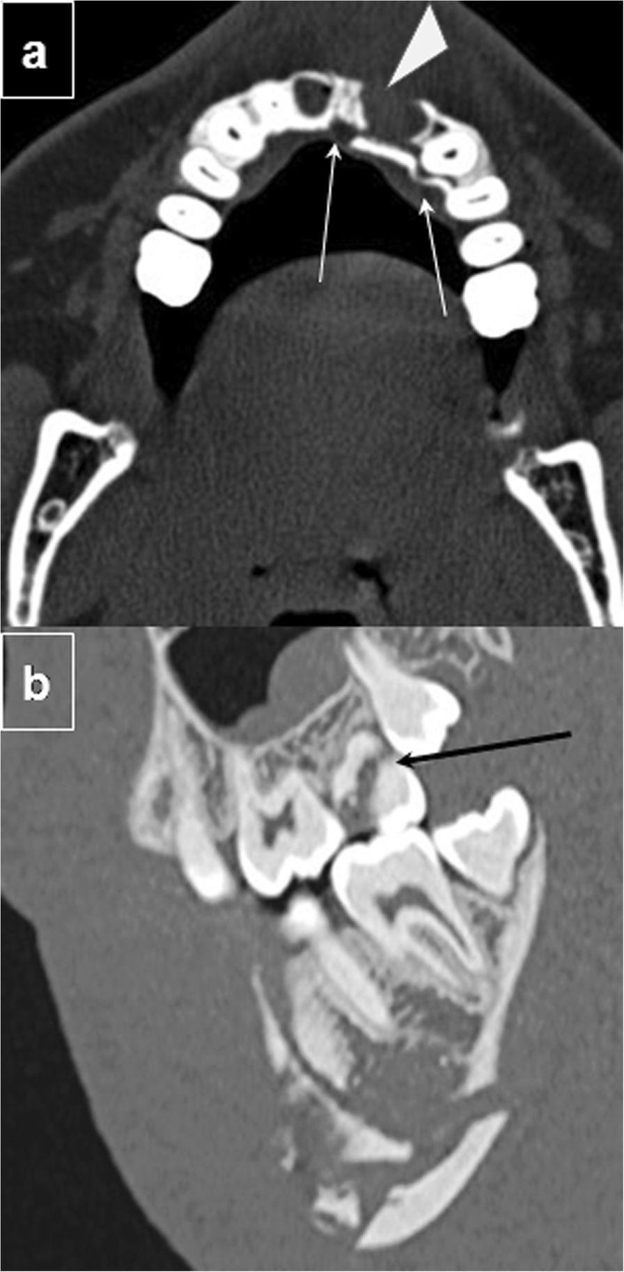 Fig. 4