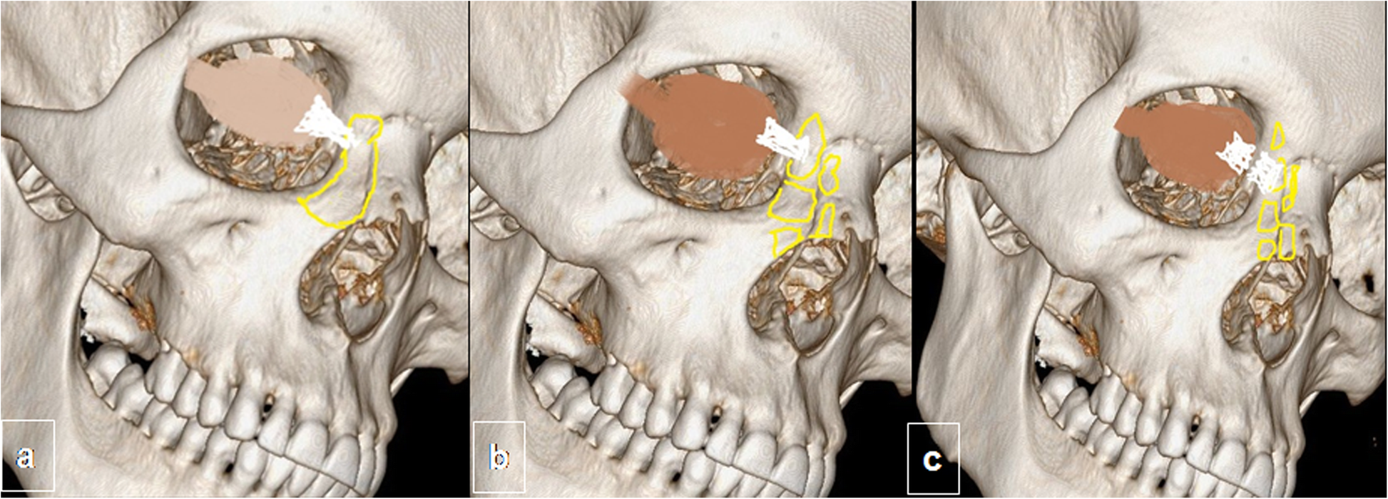 Fig. 9