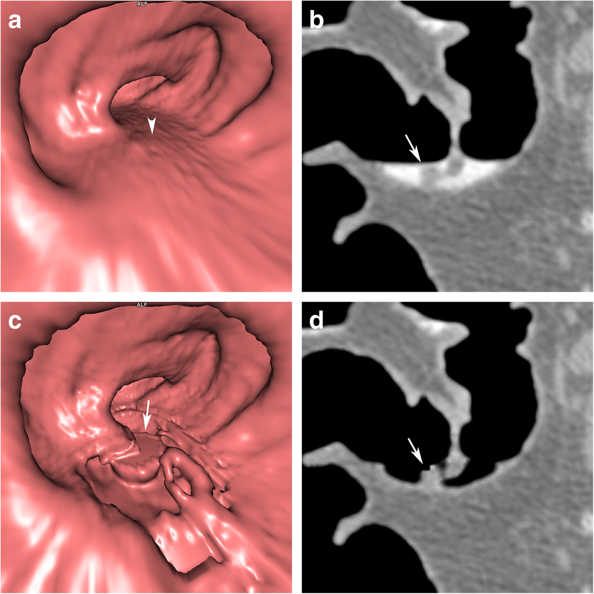 Fig. 9