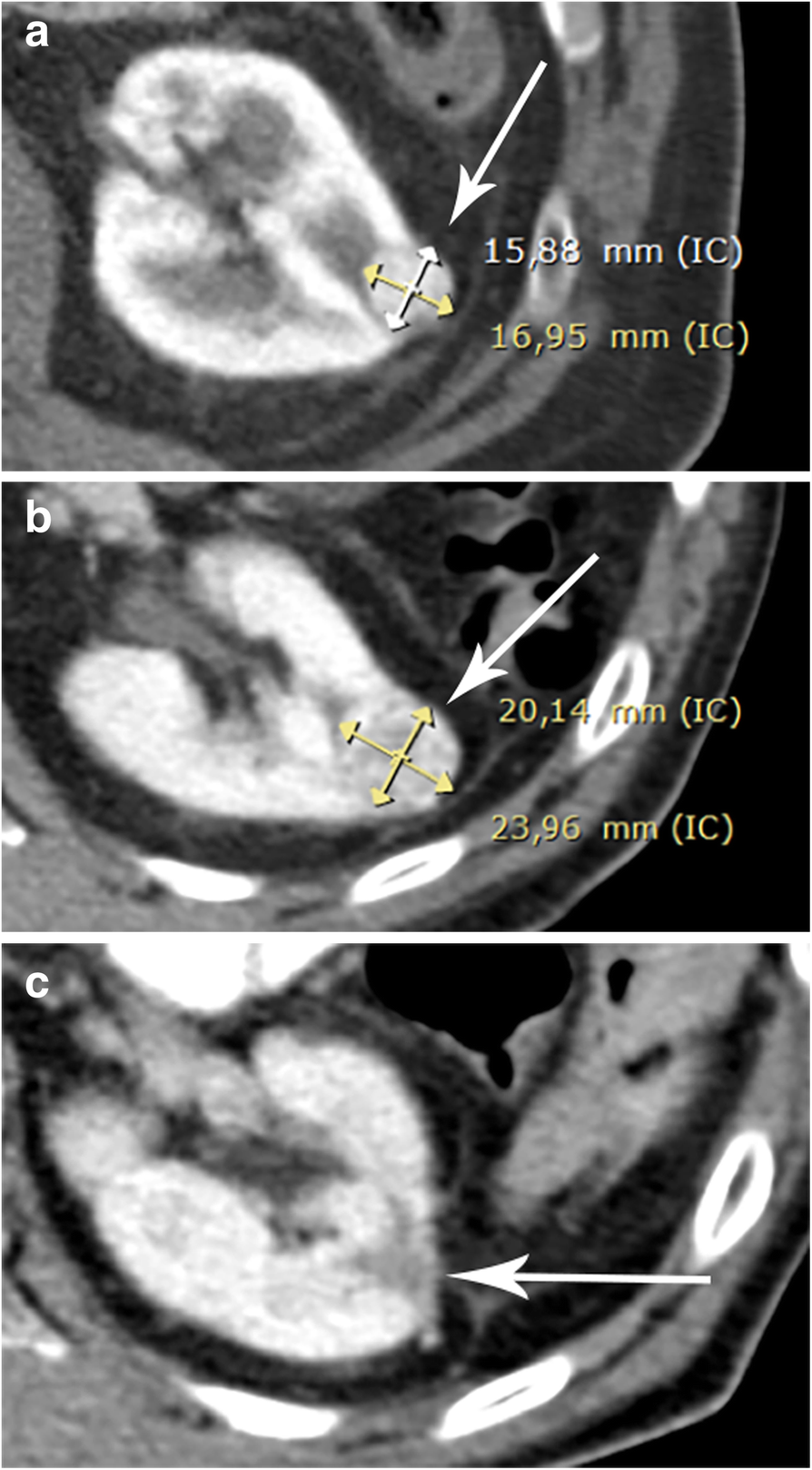 Fig. 10