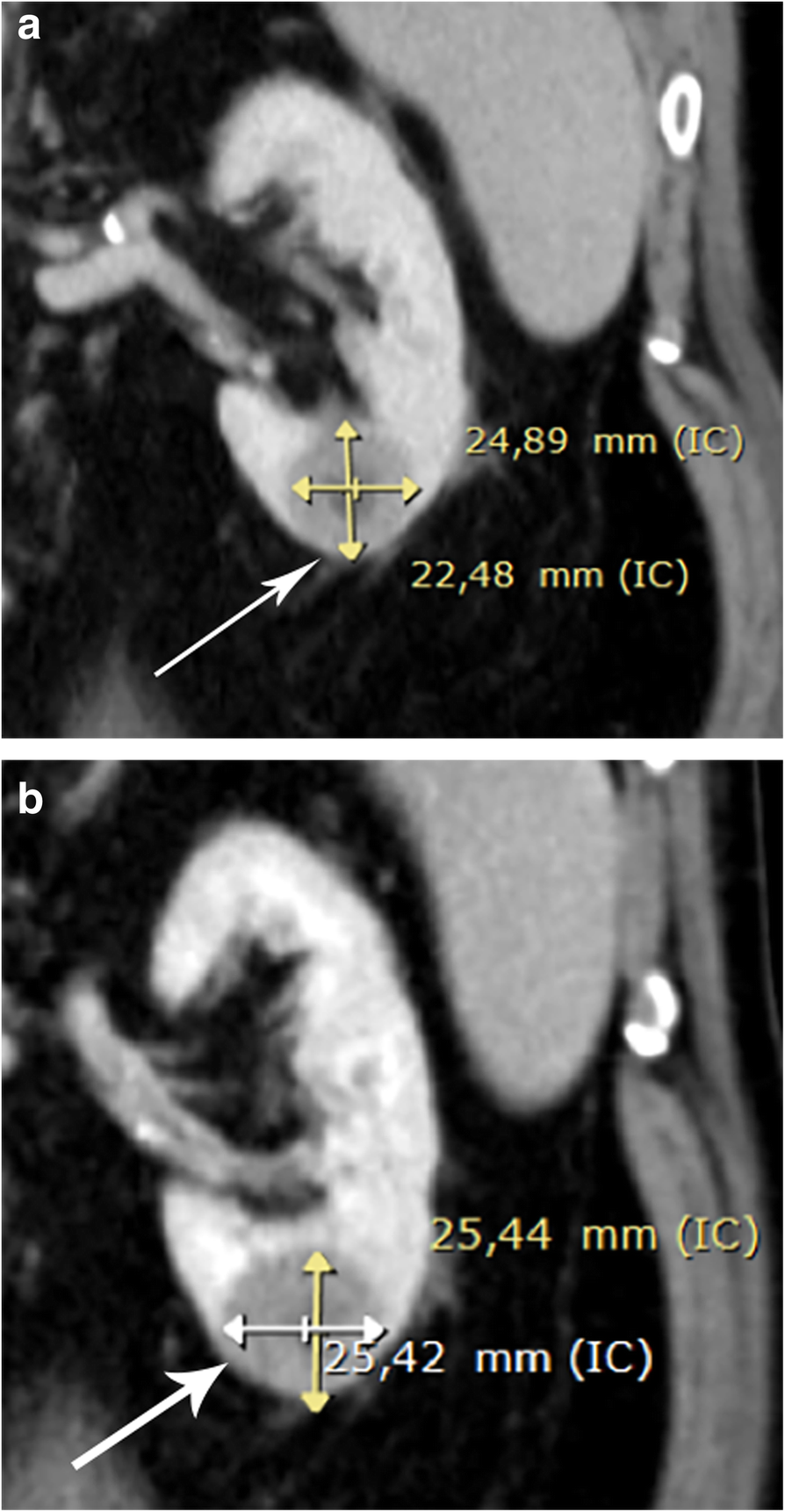 Fig. 11