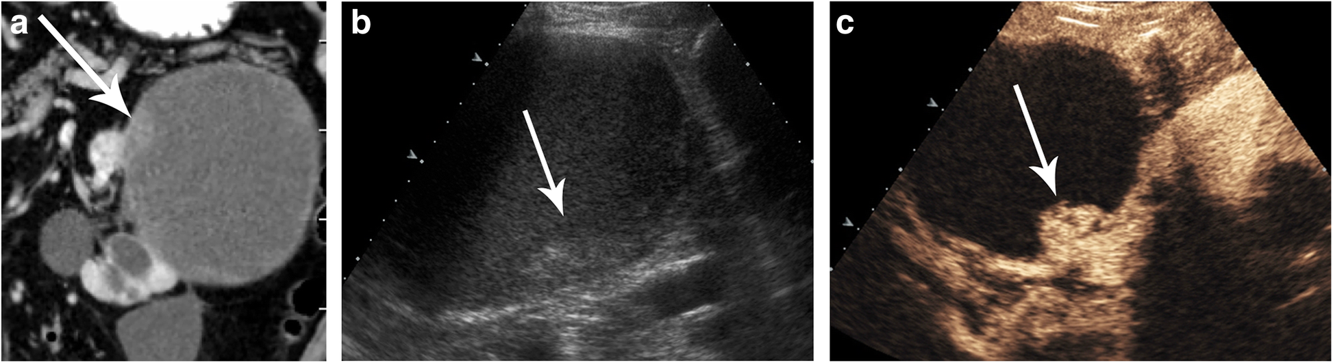 Fig. 19