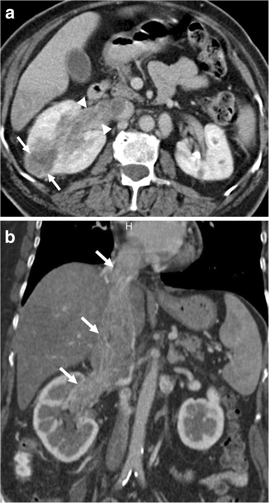 Fig. 11