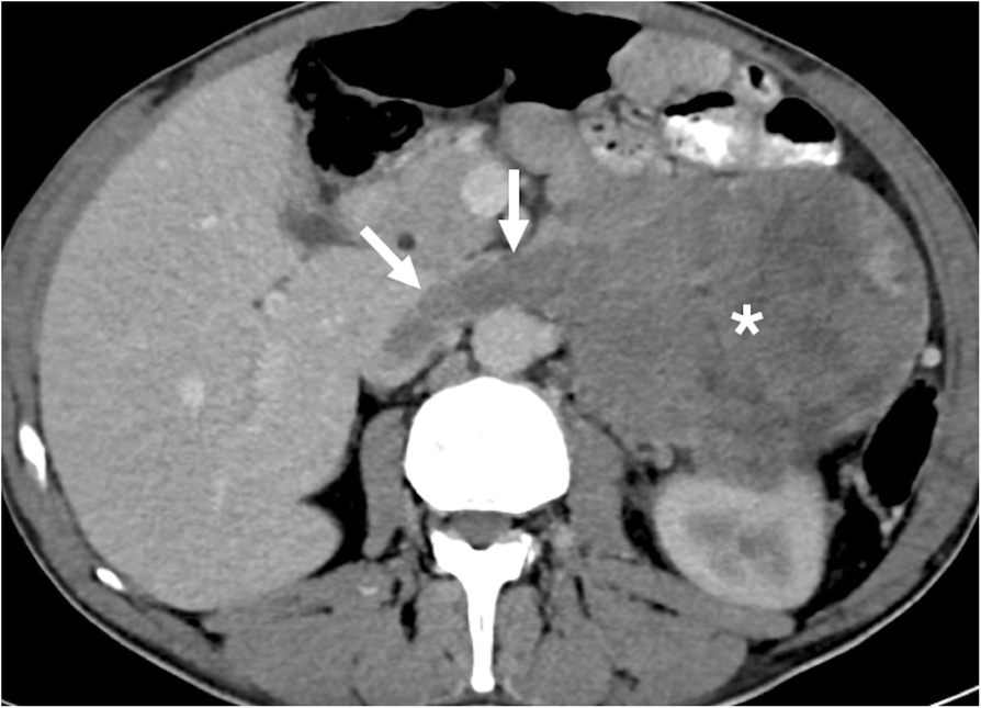 Fig. 13