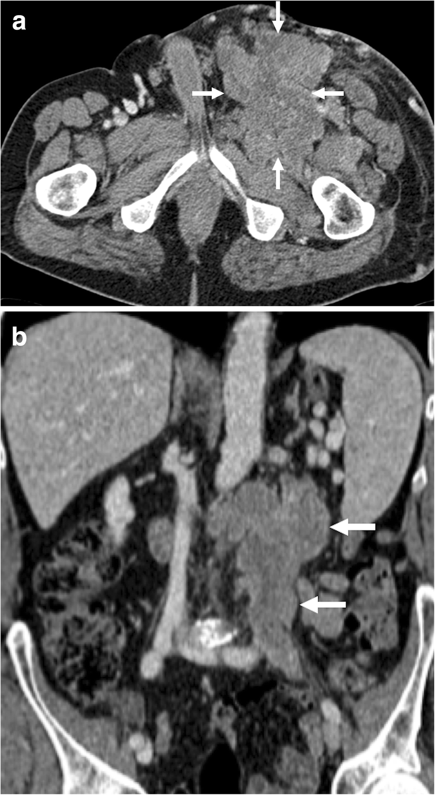 Fig. 15