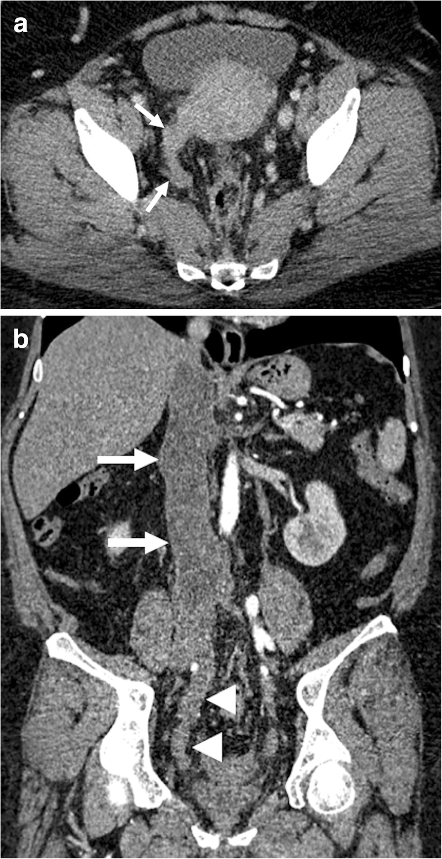 Fig. 17