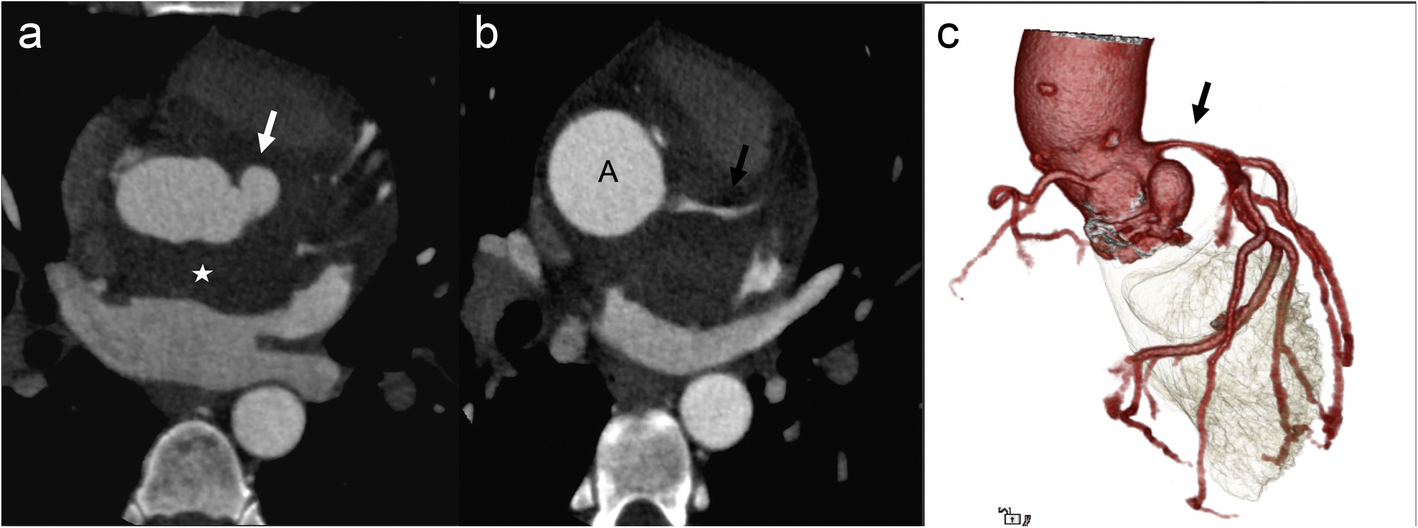 Fig. 10