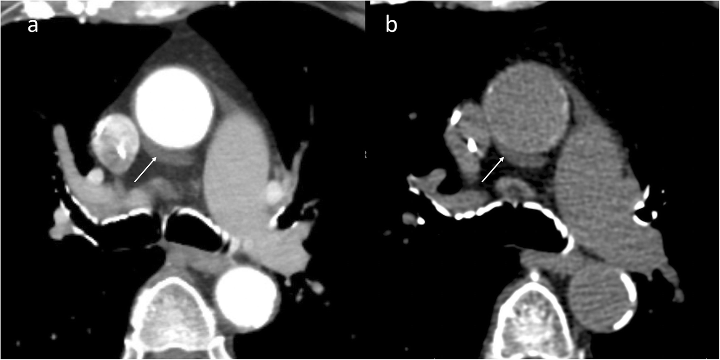 Fig. 15