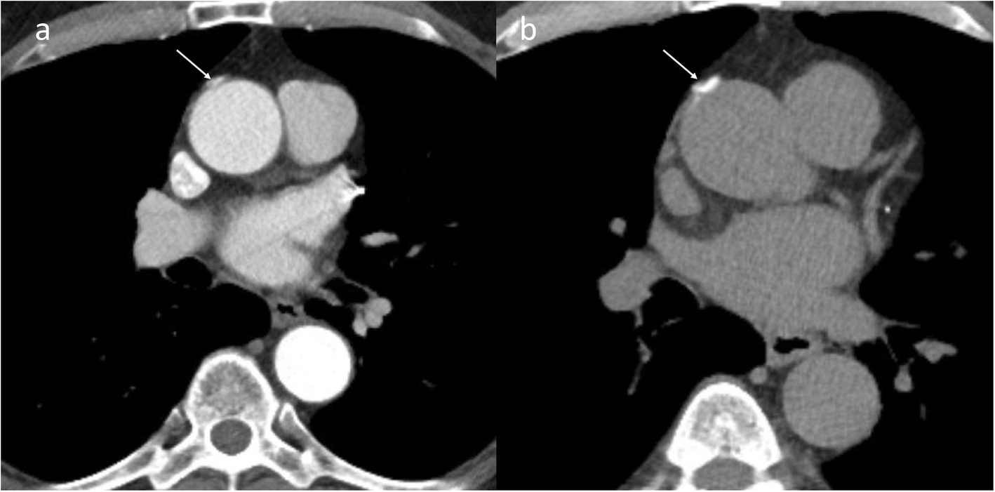 Fig. 16