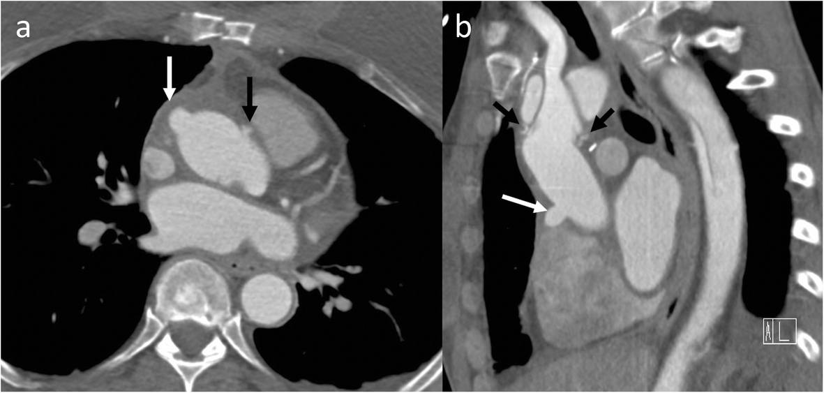 Fig. 17