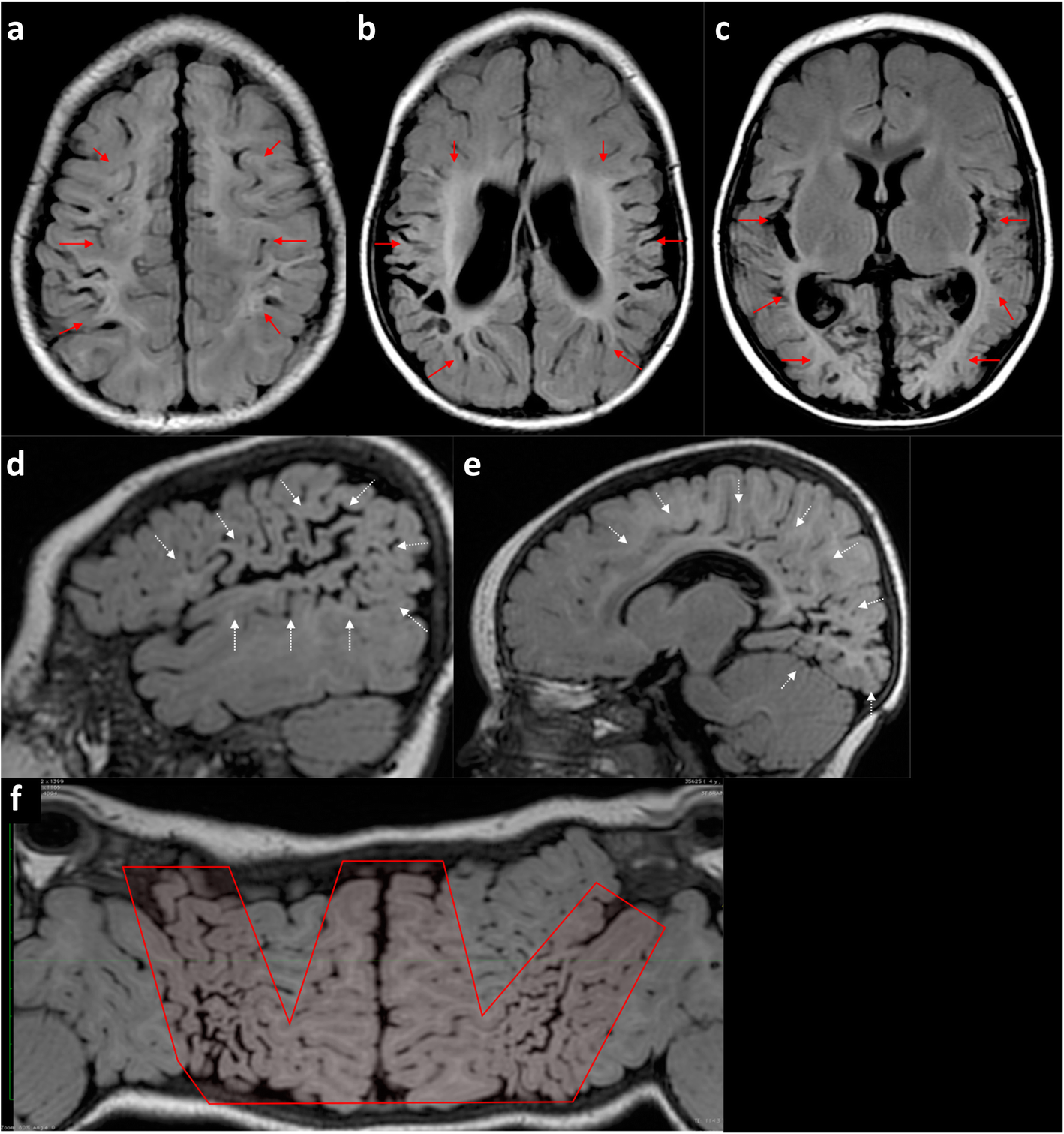 Fig. 12