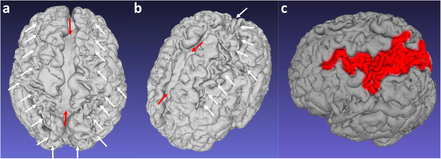 Fig. 13