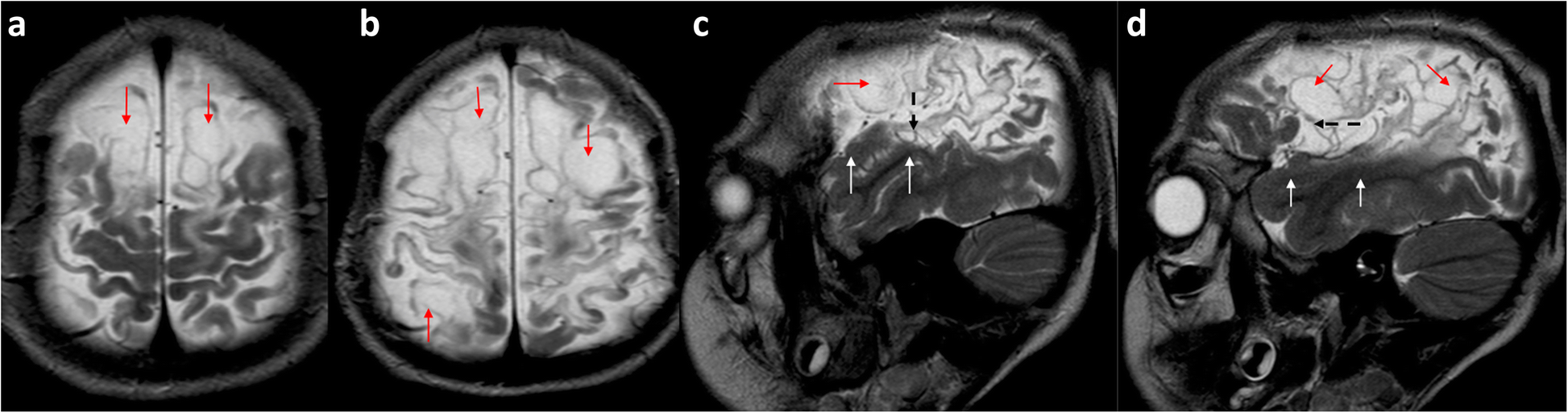 Fig. 16