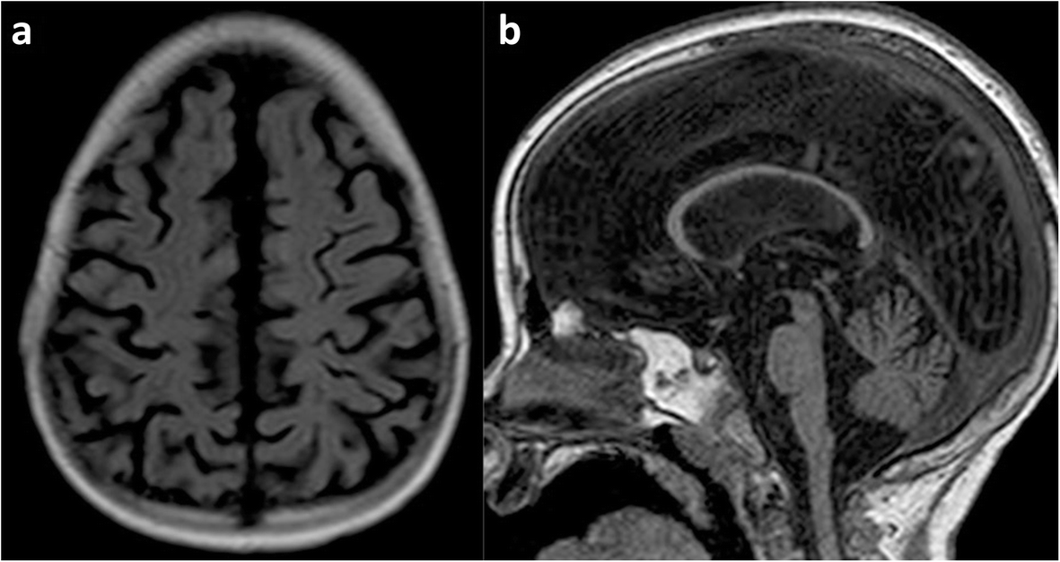 Fig. 19