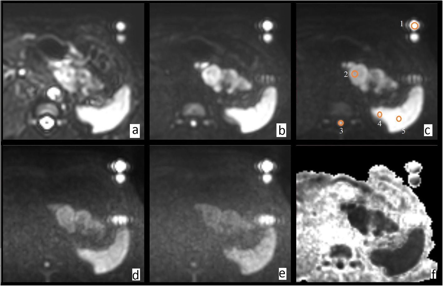 Fig. 7