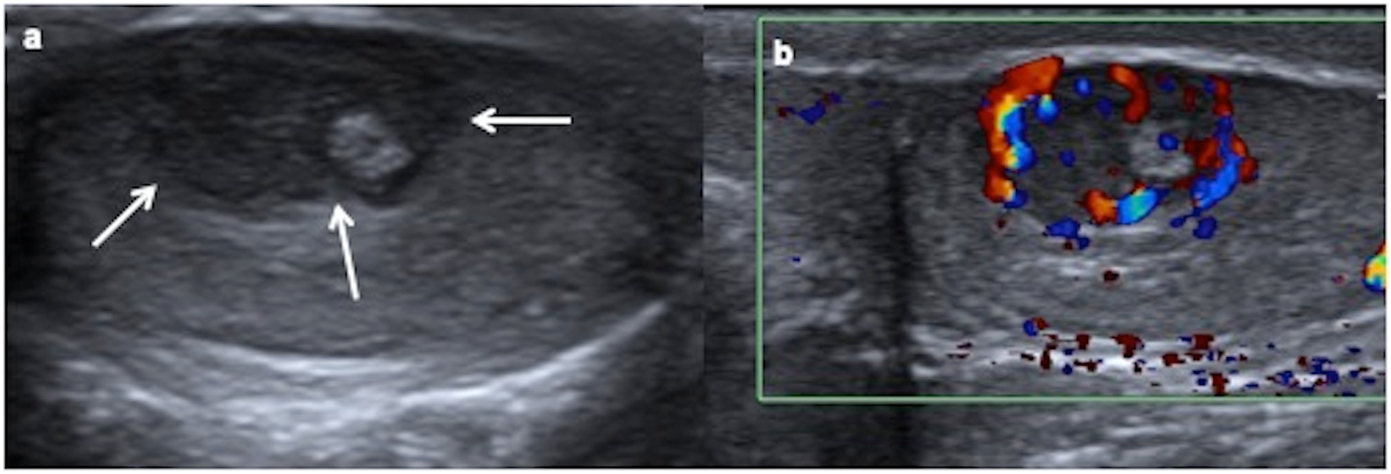 Fig. 14