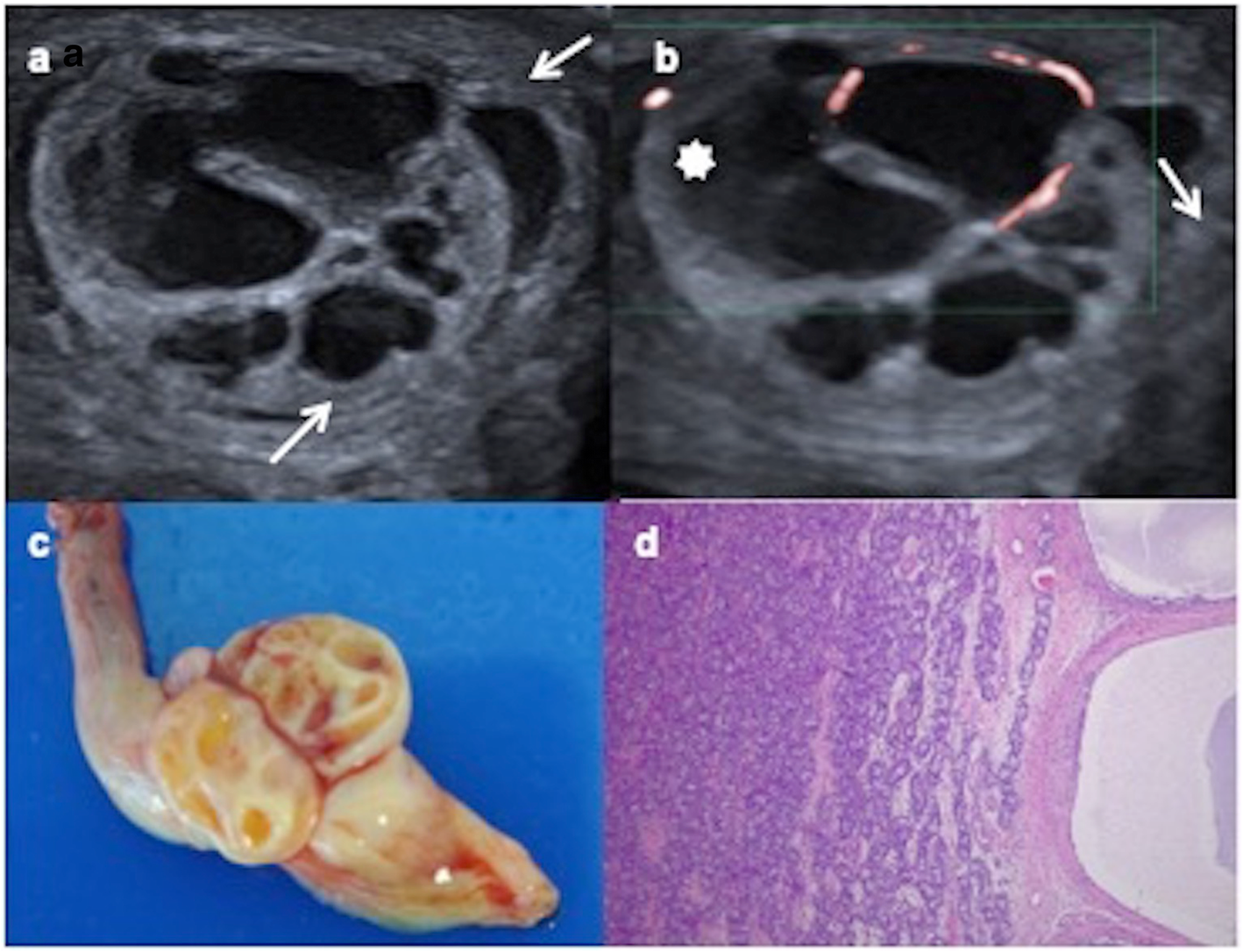 Fig. 15