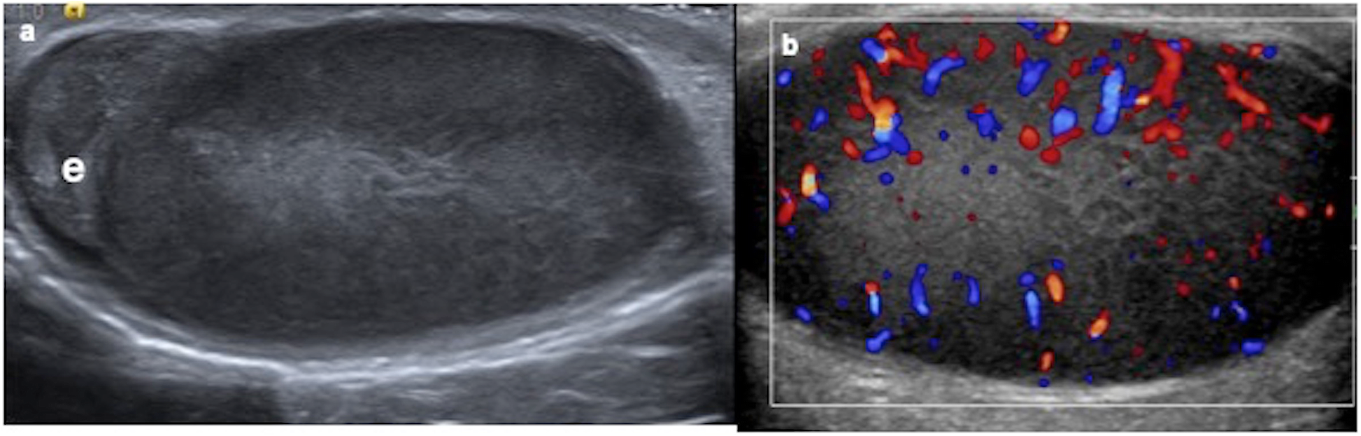 Fig. 16