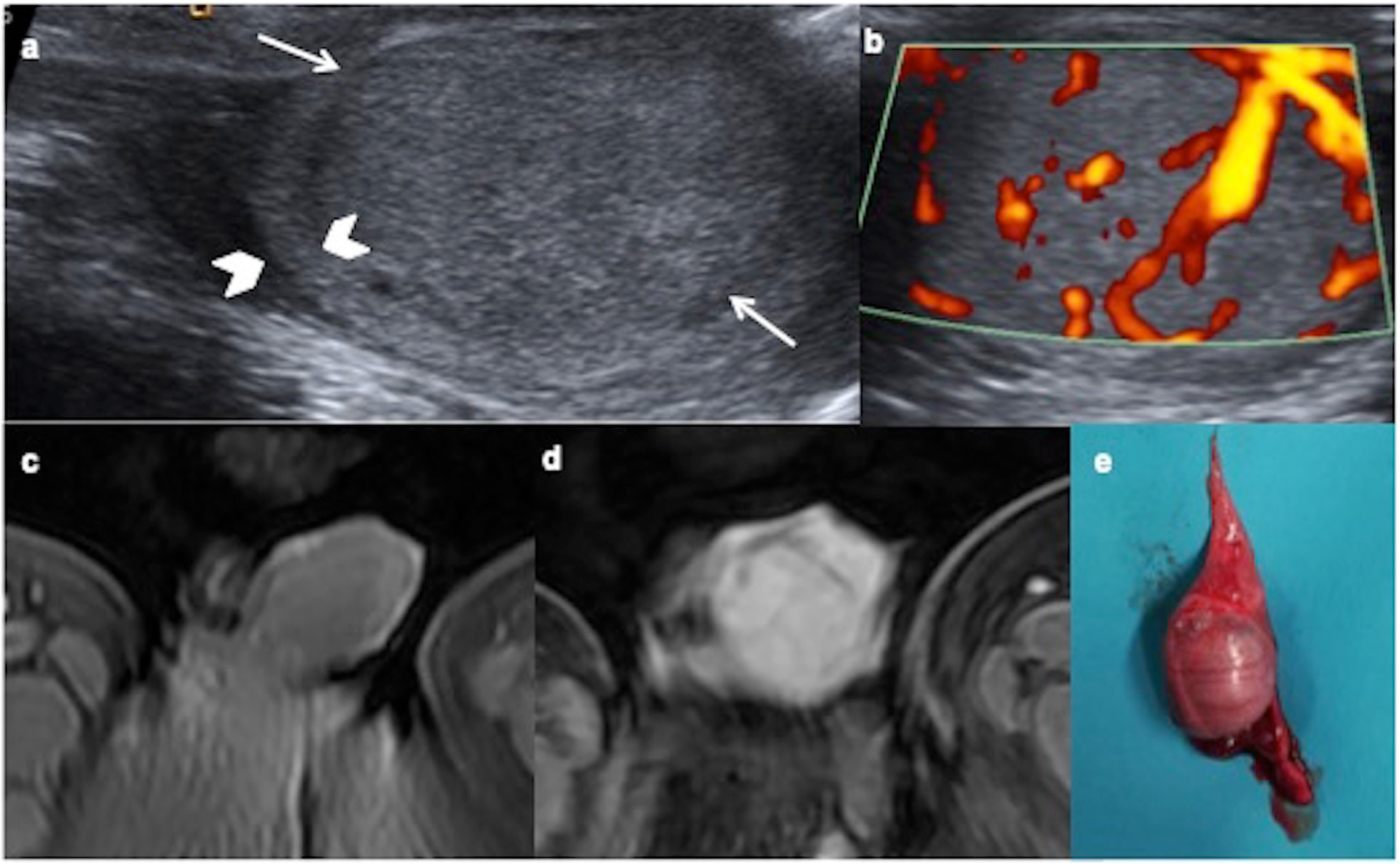 Fig. 5