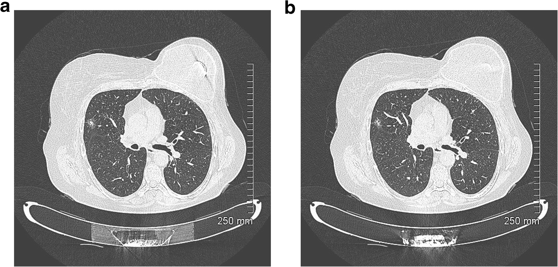 Fig. 18