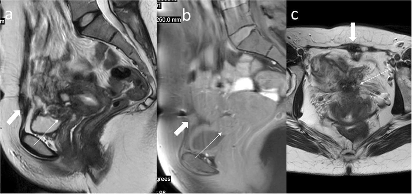 Fig. 11