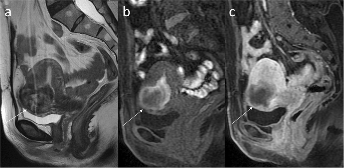 Fig. 12