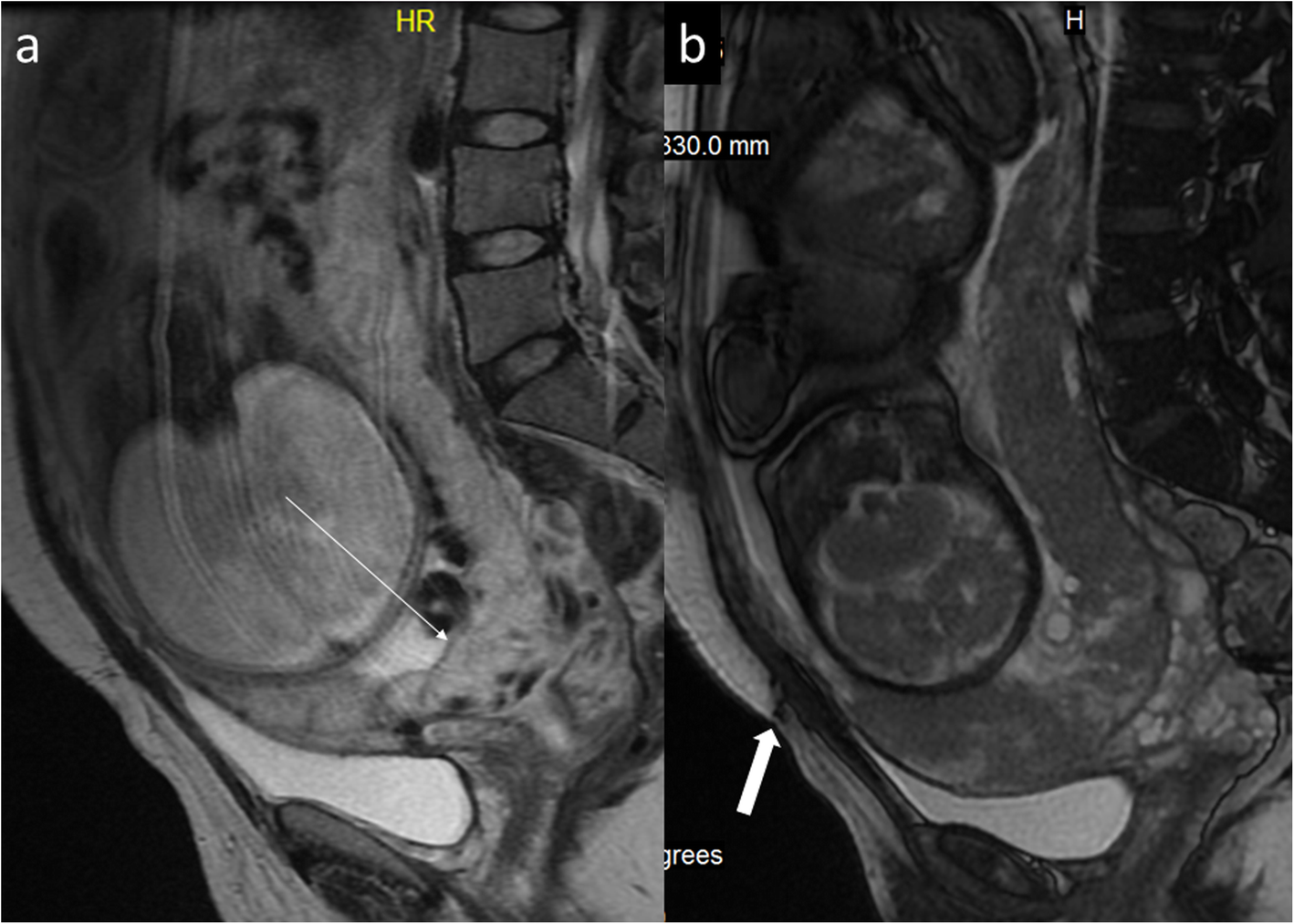 Fig. 13