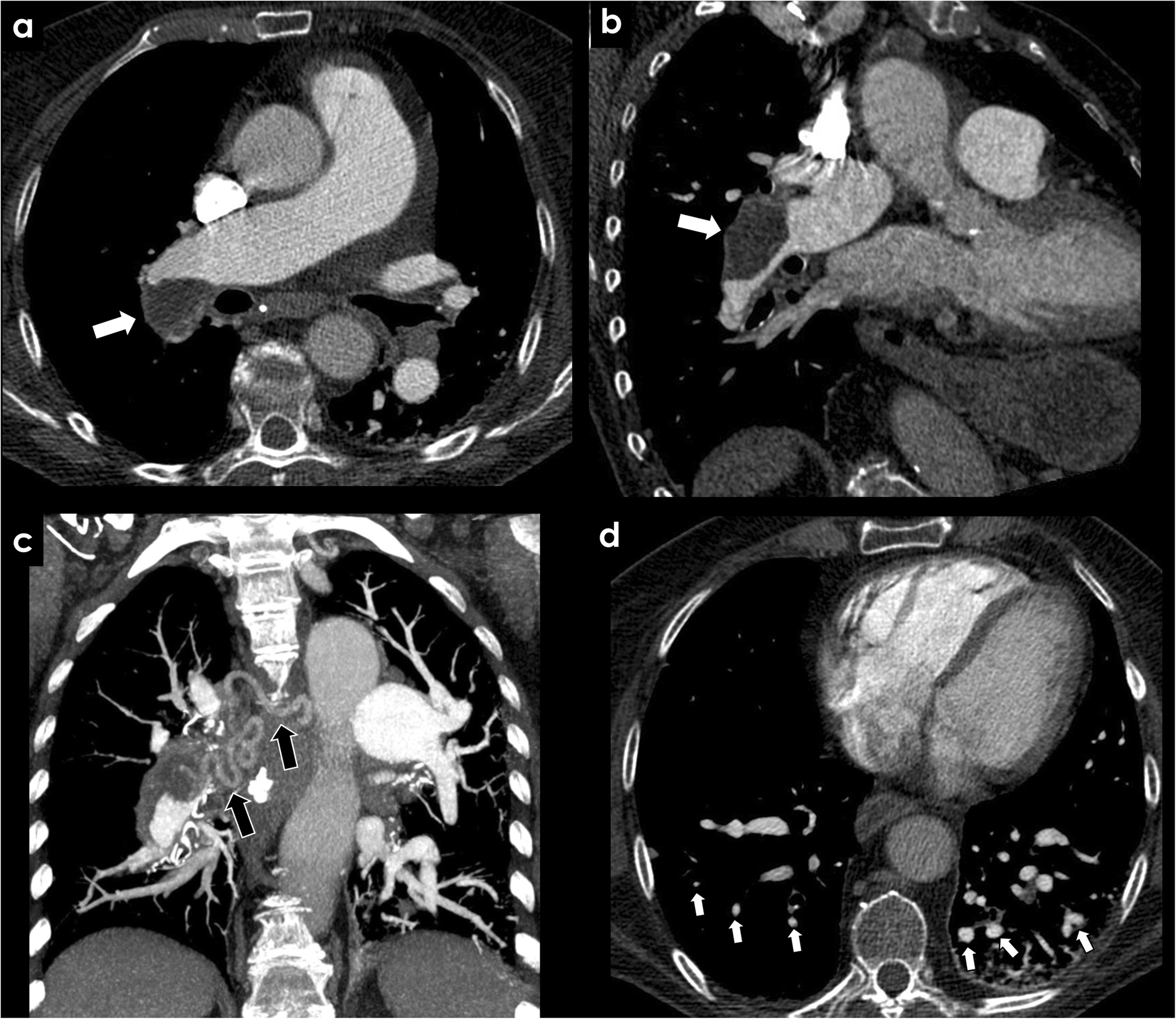 Fig. 10