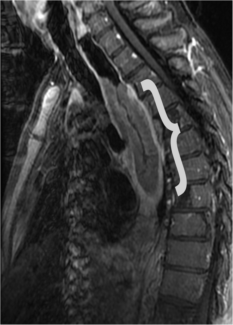 Fig. 15