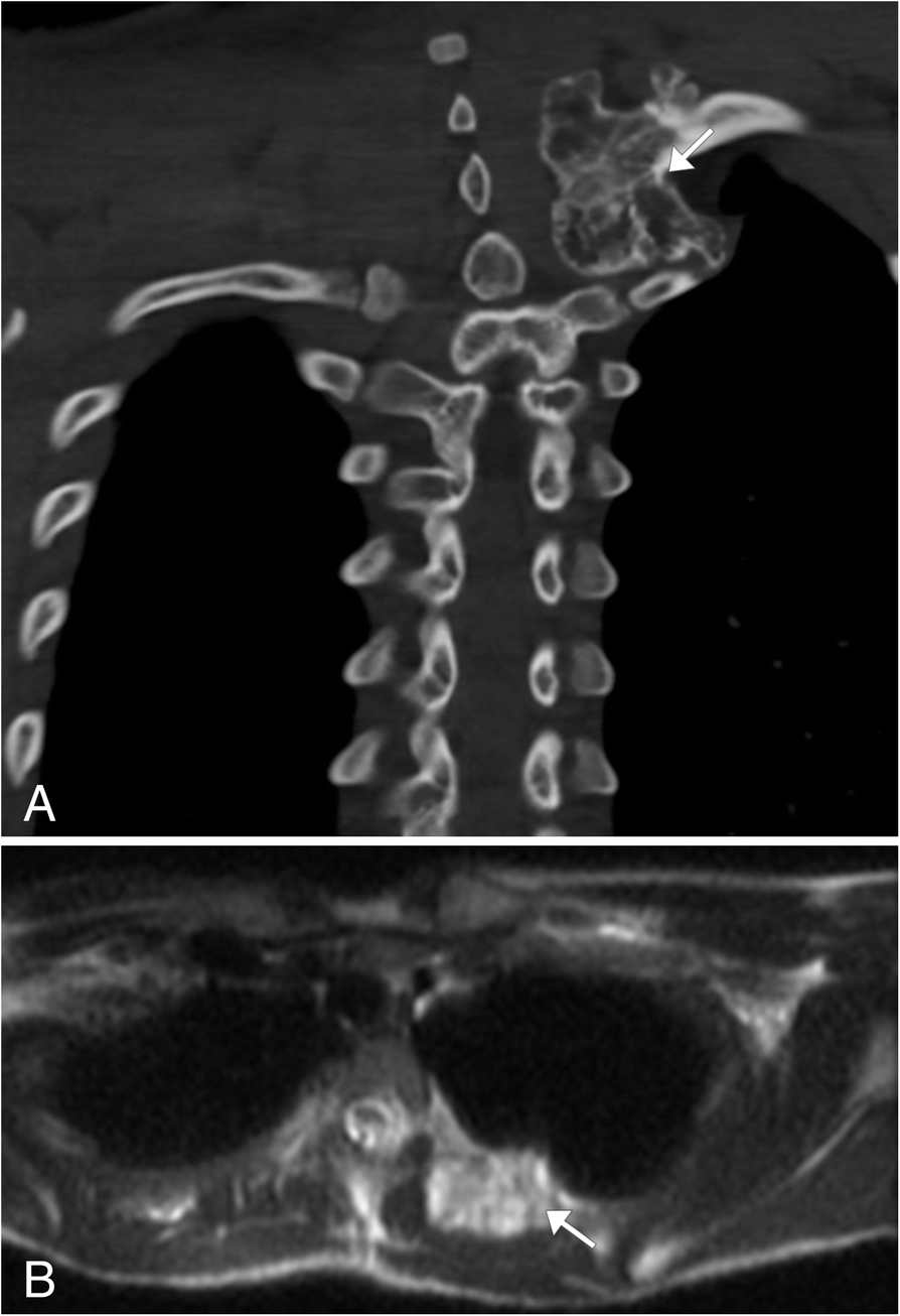 Fig. 16