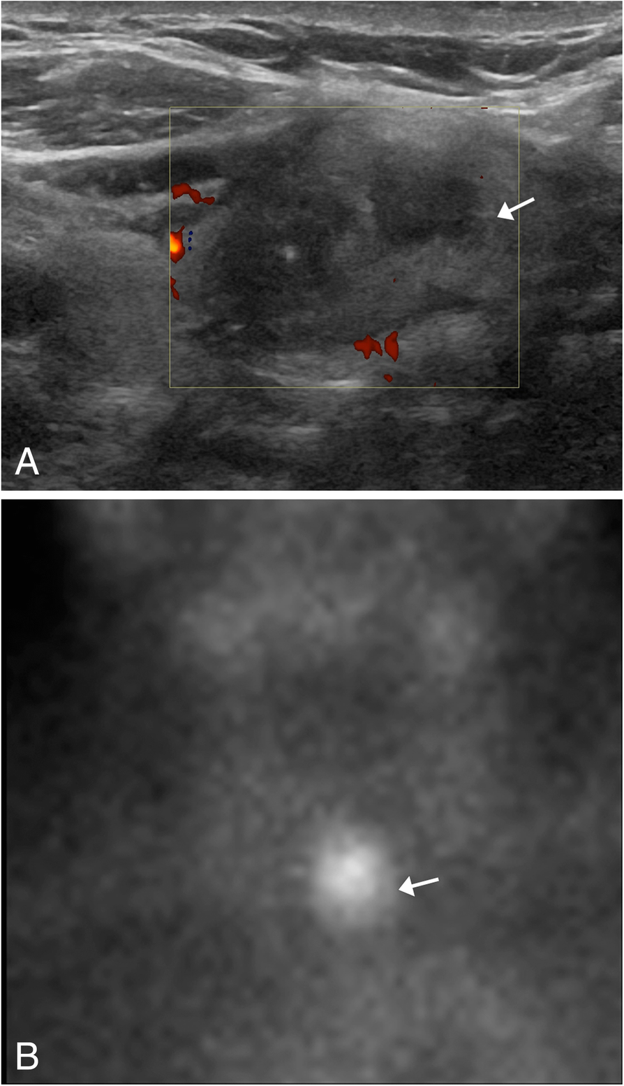 Fig. 21