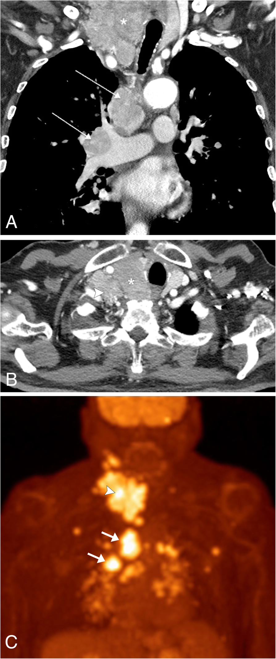 Fig. 23