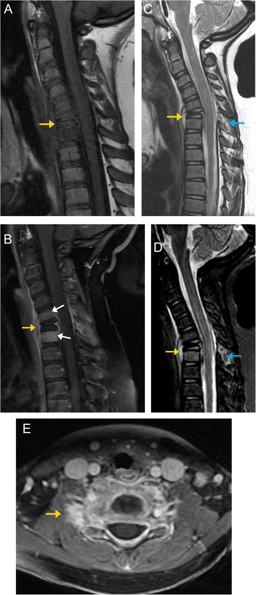 Fig. 12