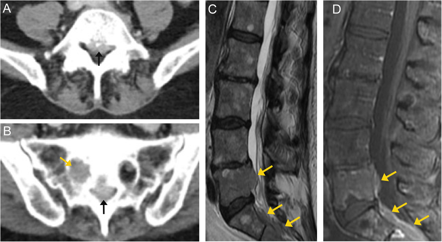 Fig. 16