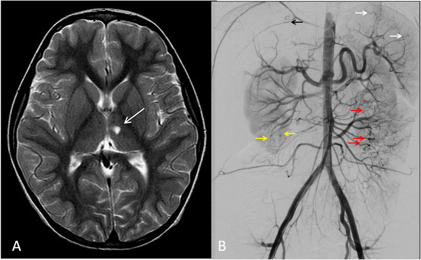 Fig. 10