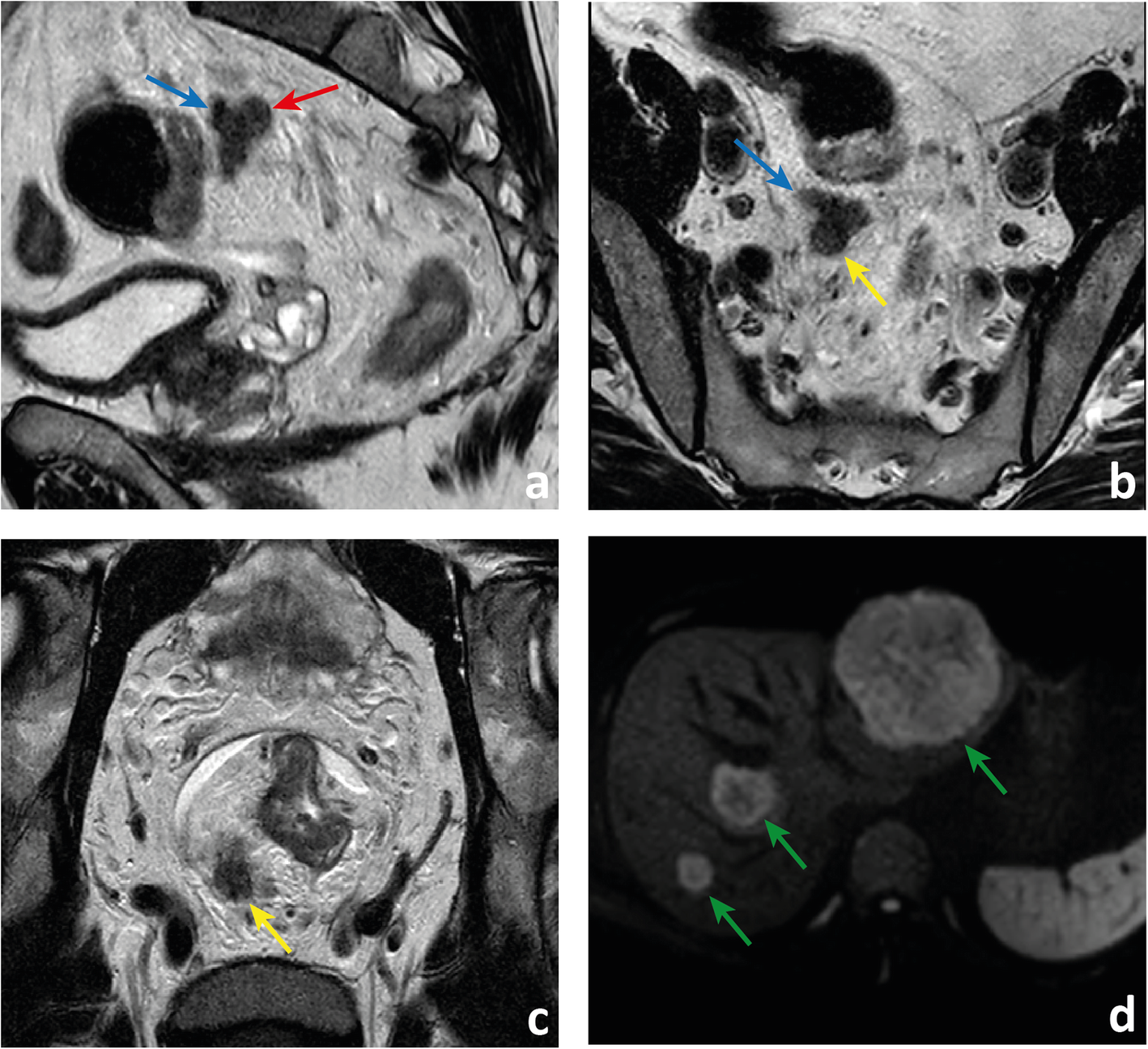 Fig. 17 