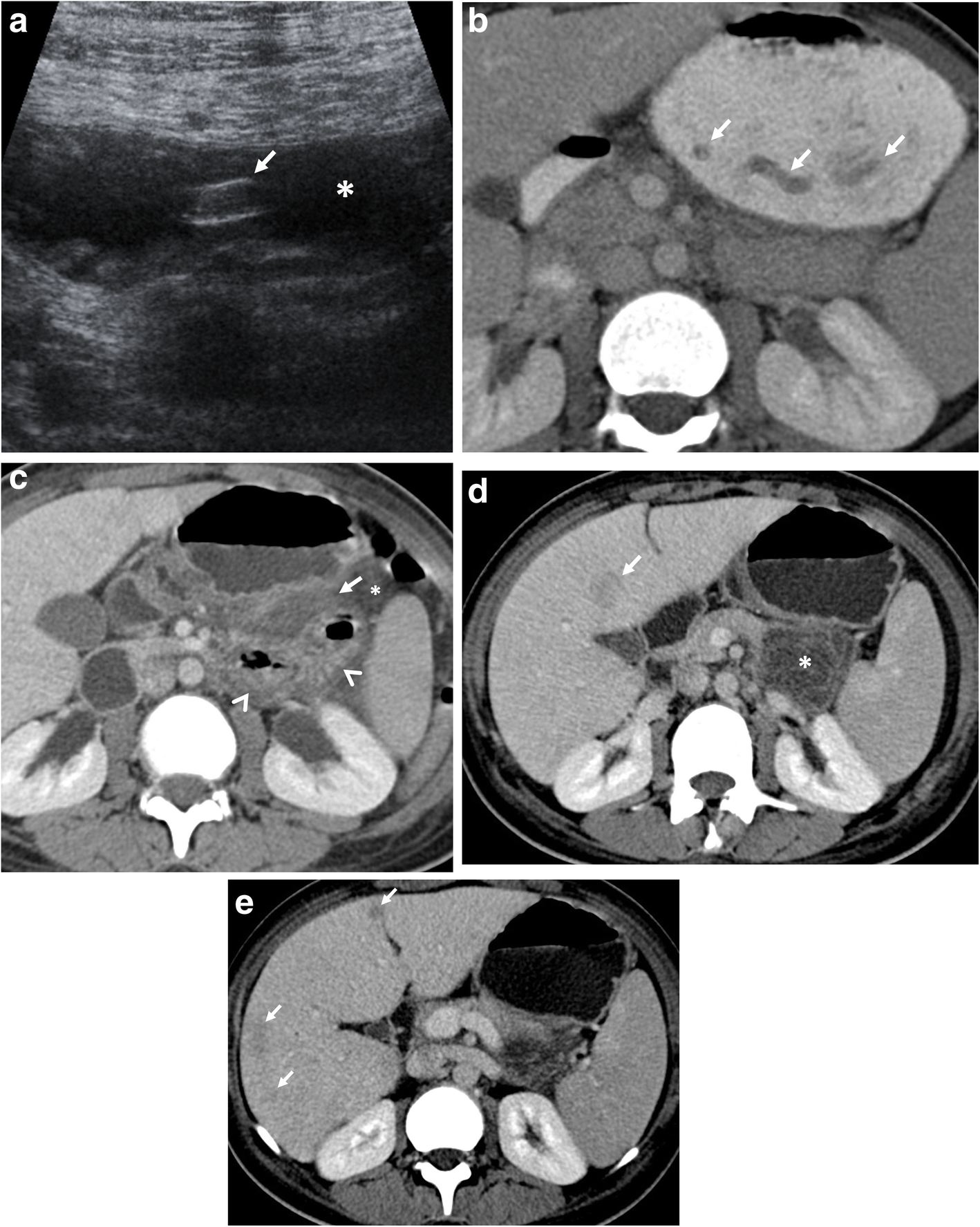 Fig. 11