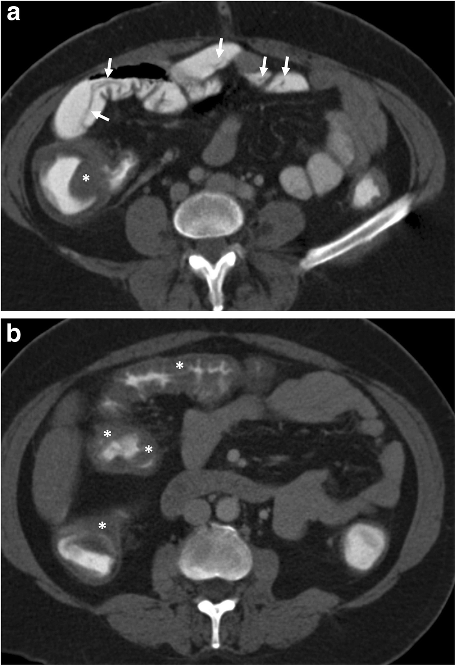 Fig. 13